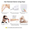 IPL Laser Hair Removal Device